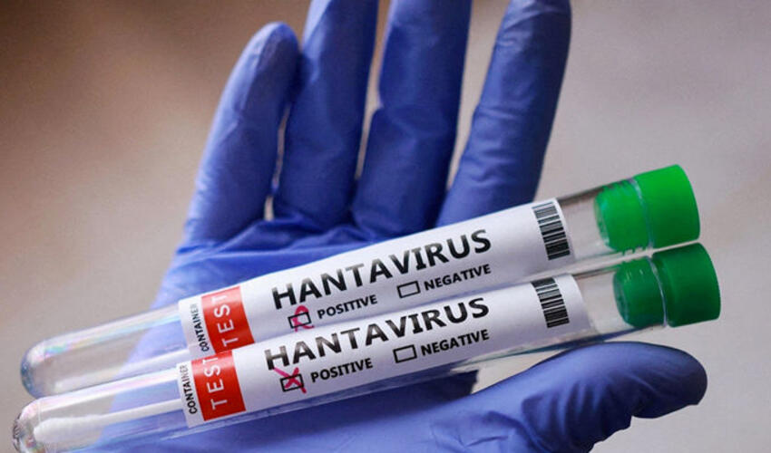 Hantavirusun otaq temperaturunda maksimum sağ qalma müddəti müəyyən edilib