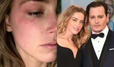 Məşhur aktyor həyat yoldaşını qısqandığı üçün pilləkəndən itələyib - FOTOLAR