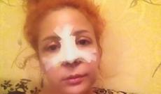 Səidə Sultan burnunu əməliyyt etdirib, göz qapaqlarındakı ətləri götüzdürdü - FOTO