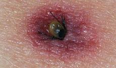 Rusları gənə yeyir - Nazirlik hərəkətə keçdi