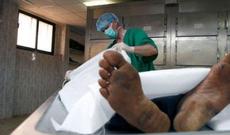 Öldüyü hesab edilən qadın morqda dirilib