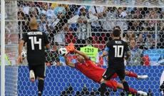 Messinin penaltisini qaytaran qapıçı “Qarabağ”da!