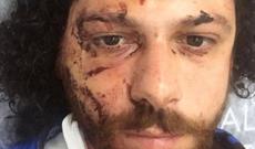 Türkiyəli aktyor barda döyüldü