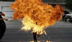 Keçmiş universitet müəllimi özünü yandırdı