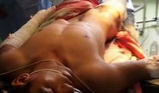 Məcburi köçkün Tərtərdə minaya düşdü - Video