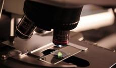 Vərəm və xərçəngi tez aşkarlayan cihaz yaradıldı