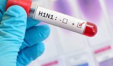 “Azərbaycanda 16 nəfər donuz qripinə yoluxub” iddiası